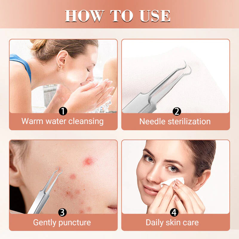 LUXGRIP - Blackhead Remover Kit