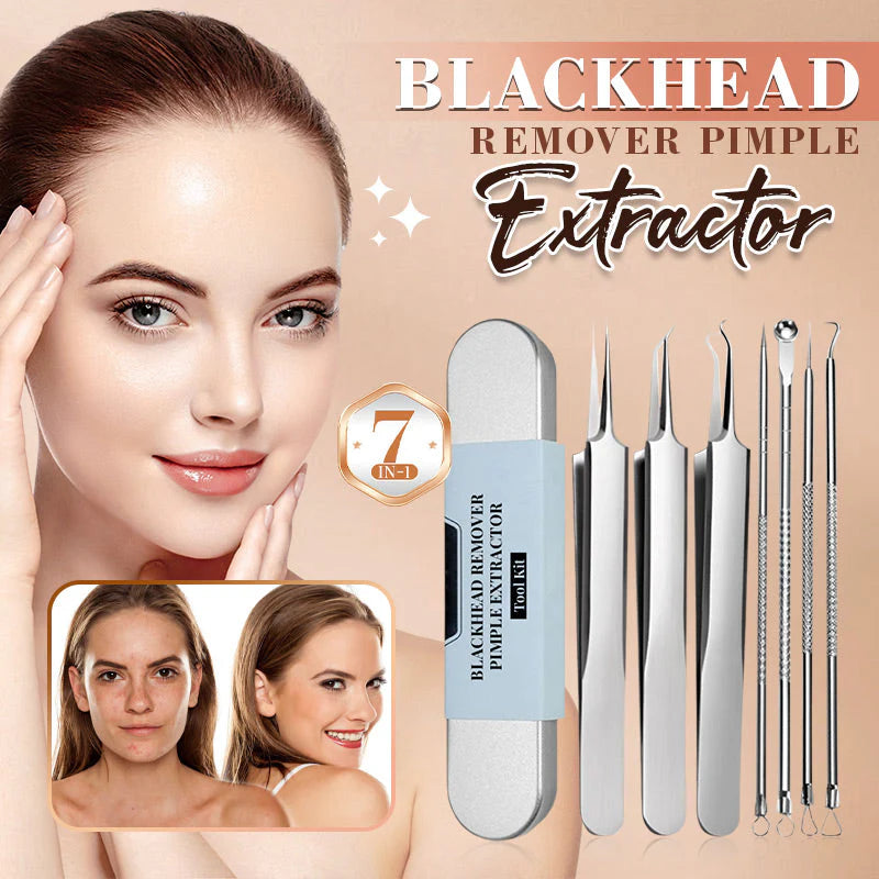 LUXGRIP - Blackhead Remover Kit