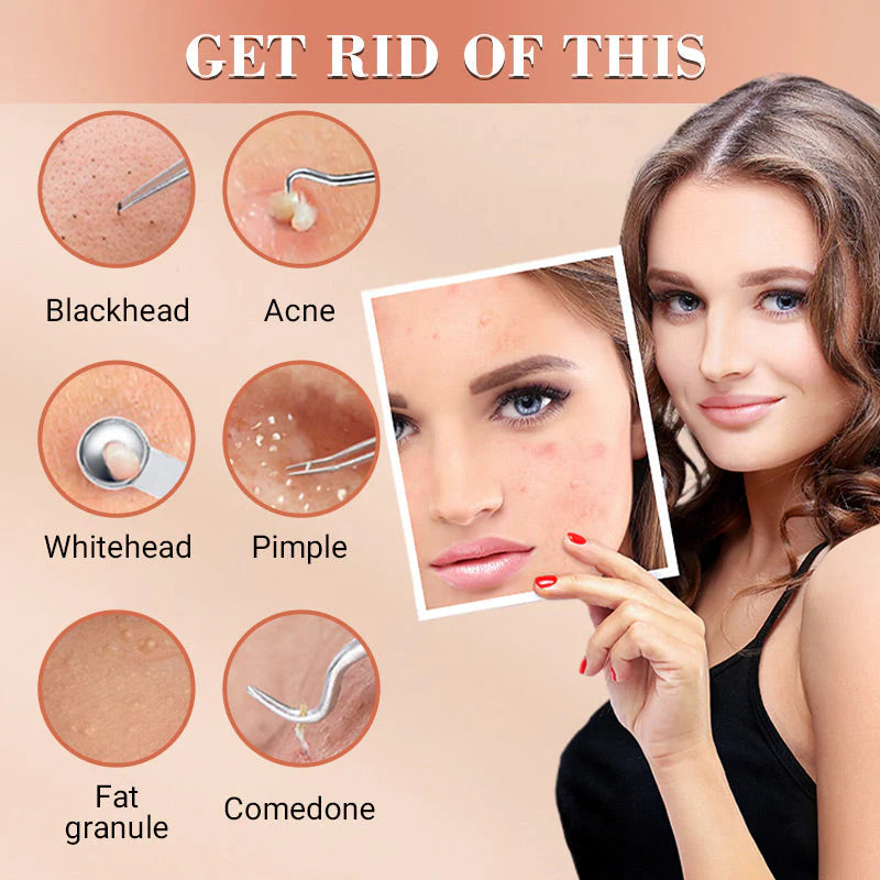 LUXGRIP - Blackhead Remover Kit