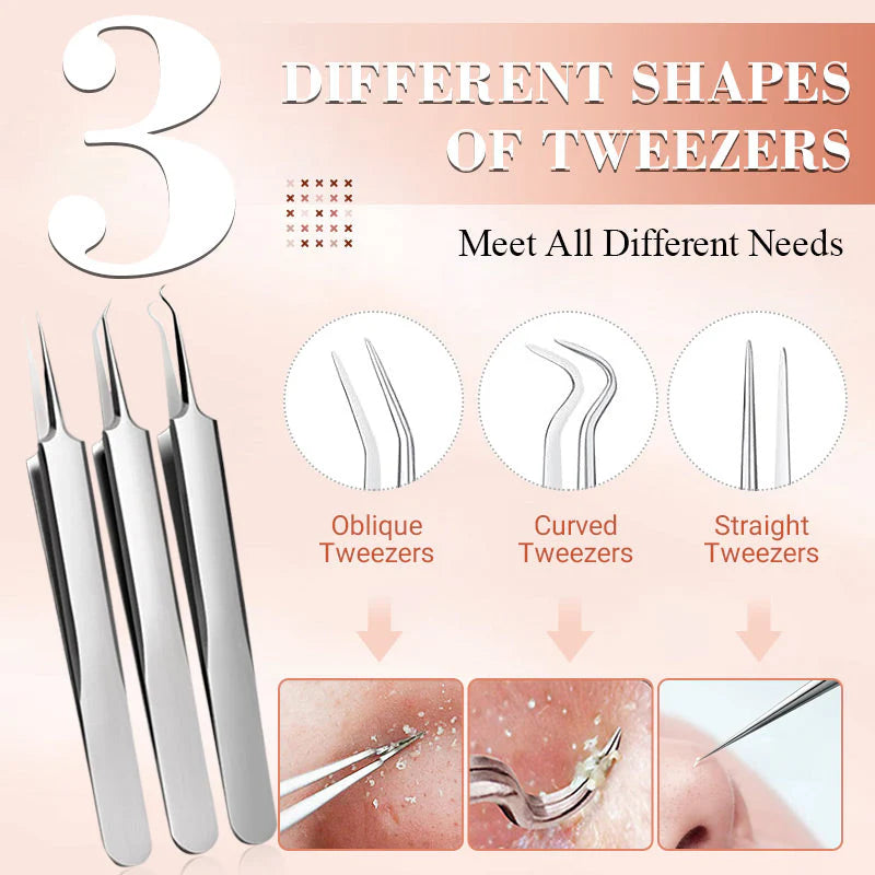 LUXGRIP - Blackhead Remover Kit